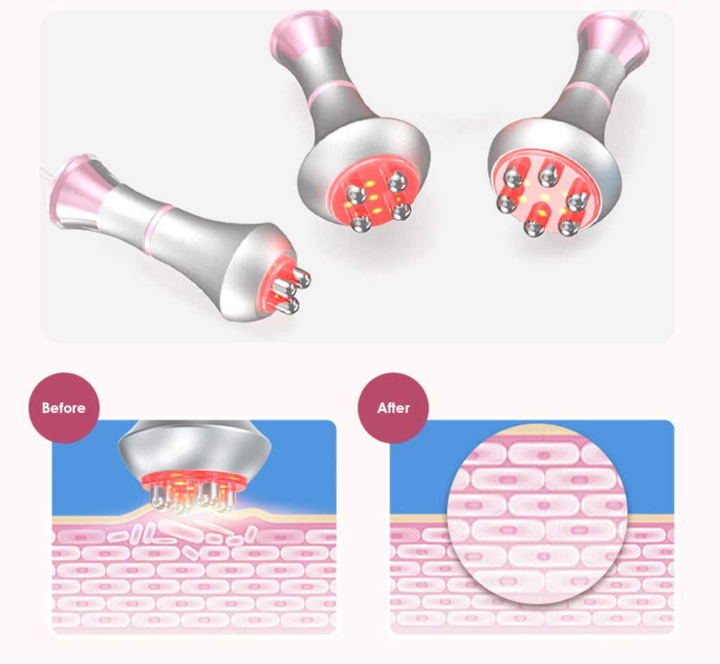 SQ121A Pro 6in1 80K 캐비테이션 복합 뷰티 기기 | RF · 흡입 마사지 · 레이저 패드